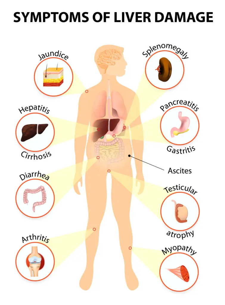 Factors-May-Damage-the-Liver-scaled